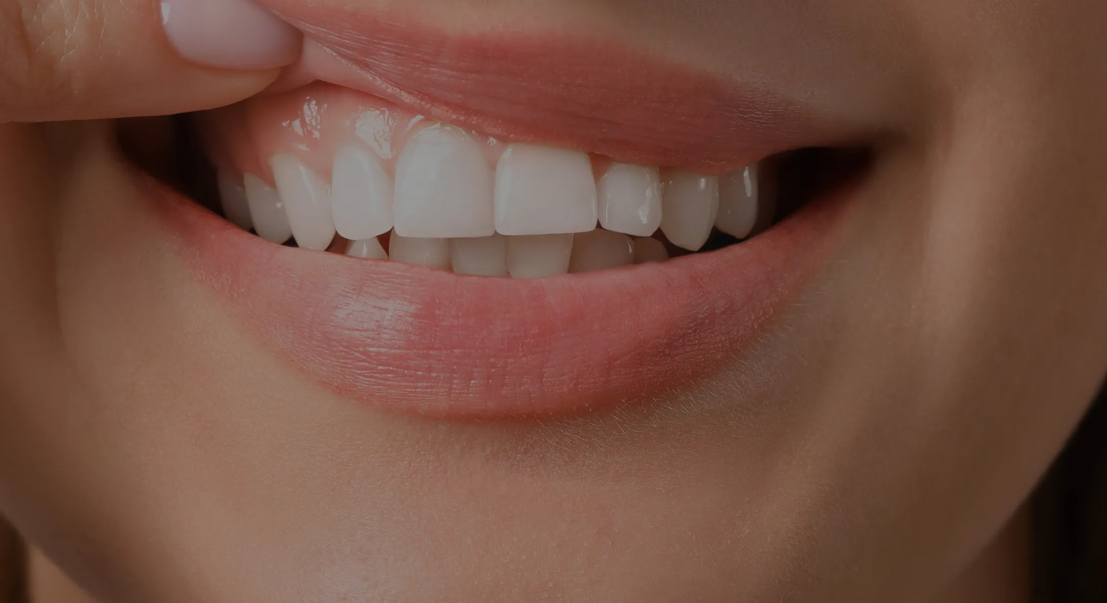 Sanatatea gingiilor